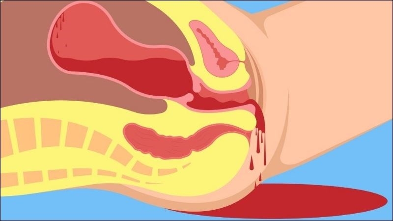 tai biến sản khoa sau sinh tai biến sản khoa sau sinh
