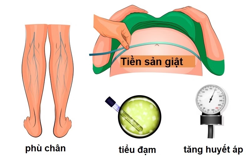tai biến sản khoa trong kỳ thai tai biến sản khoa trong kỳ thai