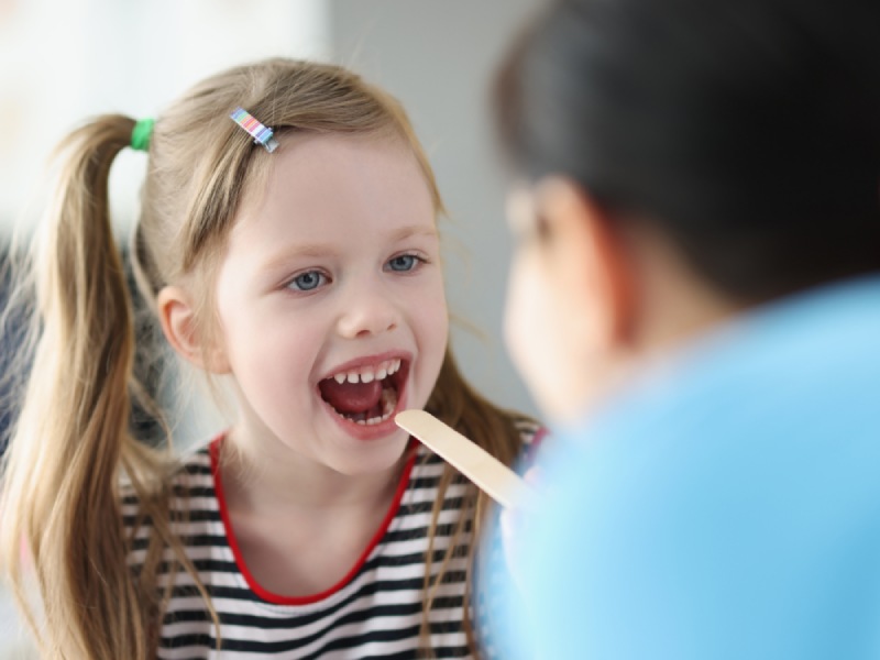 viêm họng cấp ở trẻ