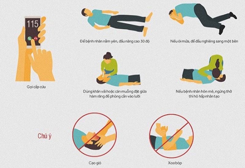 sơ cứu đột quỵ tại nhà