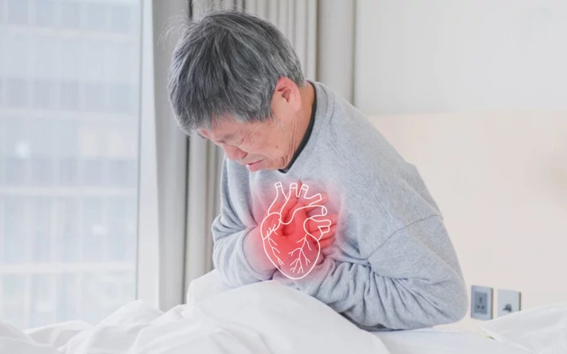 can thiệp mạch máu