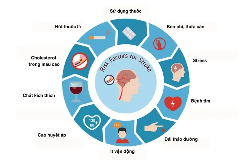 Nguyên nhân gây đột quỵ